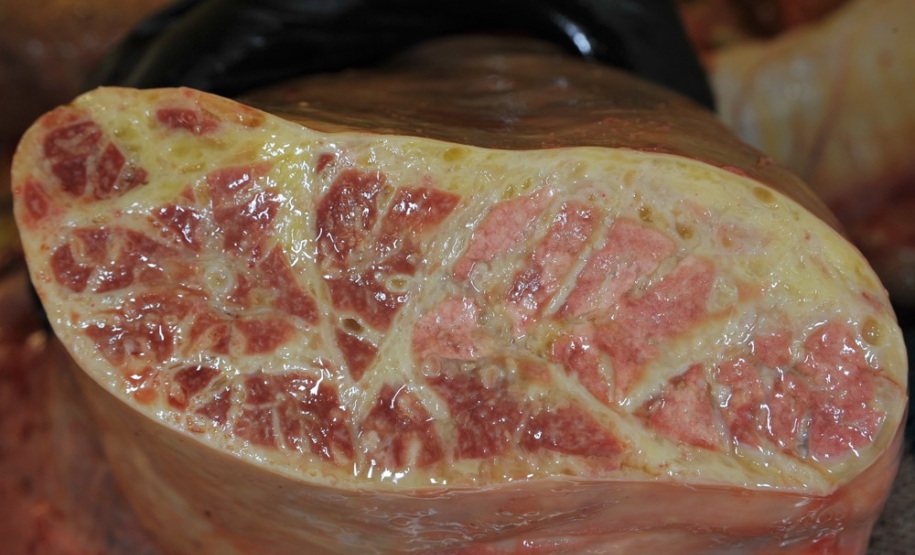 Aspecto de Pulmão de bovino com Pleuropneumonia Contagiosa Bovina Aspecto de Pulmão de bovino com
Pleuropneumonia Contagiosa Bovina